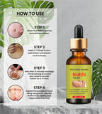 NABHI THERAPY OIL 🌿  ( BUY 1 GET 1 FREE )