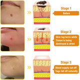 Medilisk™ Bee Venom Wart Remover Spray ⭐️⭐️⭐️⭐️⭐️4.8/5 (1600+ REVIEWS)